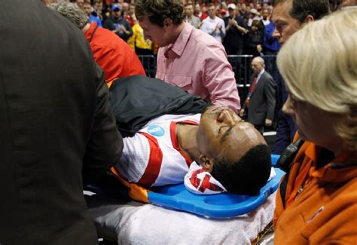 Unveiling The Truth Behind The Kevin Ware Injury: Insights And Revelations